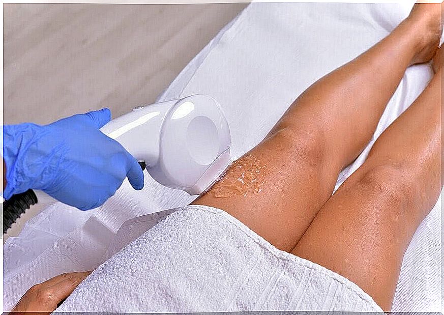 laser hair removal from bone