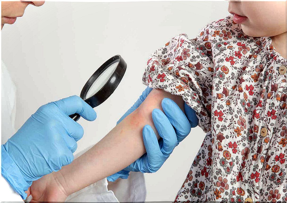 A doctor inspects the rash on a child's arm.