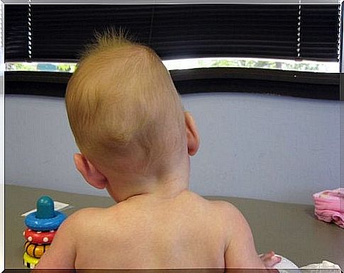 A baby with scoliosis.